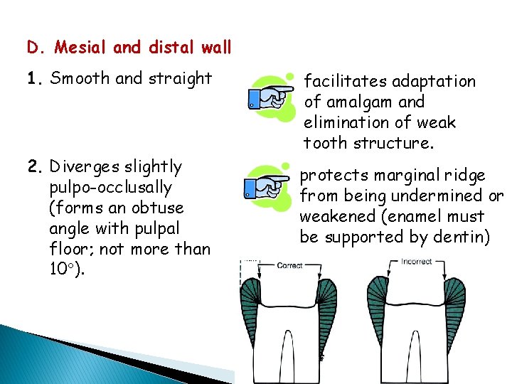 D. Mesial and distal wall 1. Smooth and straight facilitates adaptation of amalgam and