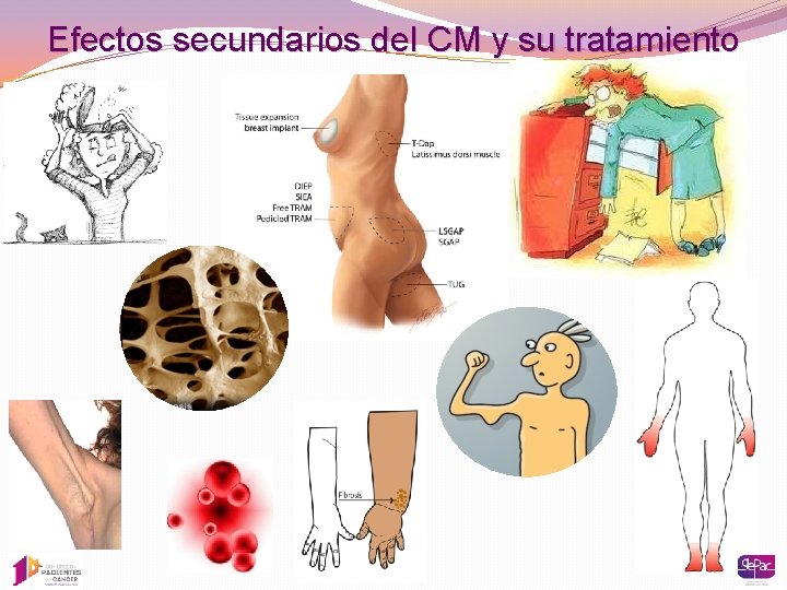 Efectos secundarios del CM y su tratamiento 