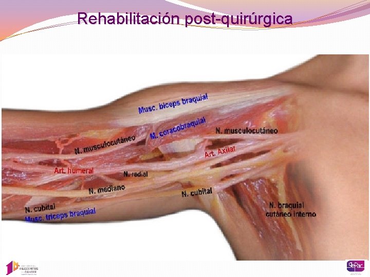 Rehabilitación post-quirúrgica 