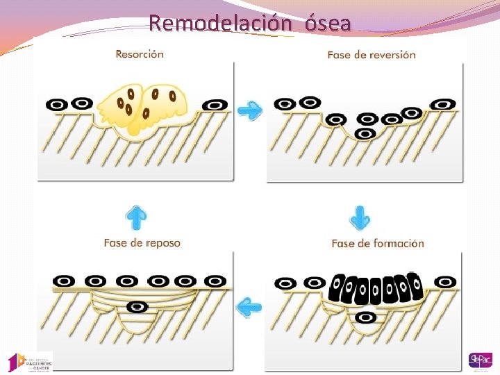 Remodelación ósea 