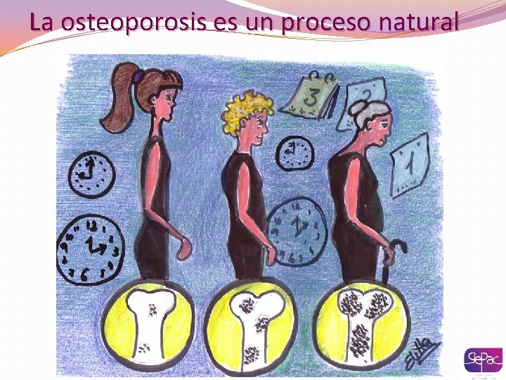 La osteoporosis es un proceso natural 
