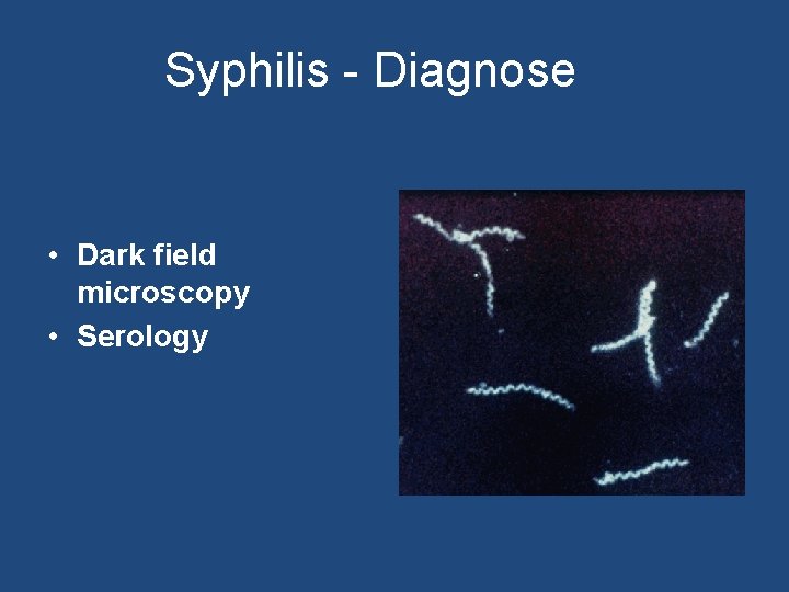 Syphilis - Diagnose • Dark field microscopy • Serology 