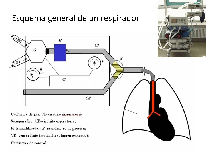 Esquema general de un respirador 