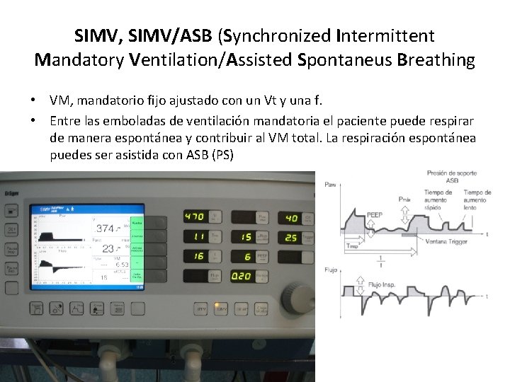 SIMV, SIMV/ASB (Synchronized Intermittent Mandatory Ventilation/Assisted Spontaneus Breathing • VM, mandatorio fijo ajustado con