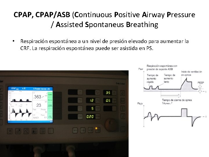 CPAP, CPAP/ASB (Continuous Positive Airway Pressure / Assisted Spontaneus Breathing • Respiración espontánea a