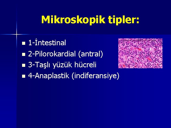 Mikroskopik tipler: 1 -İntestinal n 2 -Pilorokardial (antral) n 3 -Taşlı yüzük hücreli n