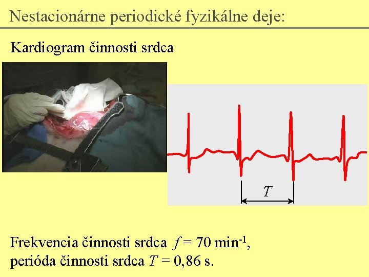 Nestacionárne periodické fyzikálne deje: Kardiogram činnosti srdca T Frekvencia činnosti srdca f = 70