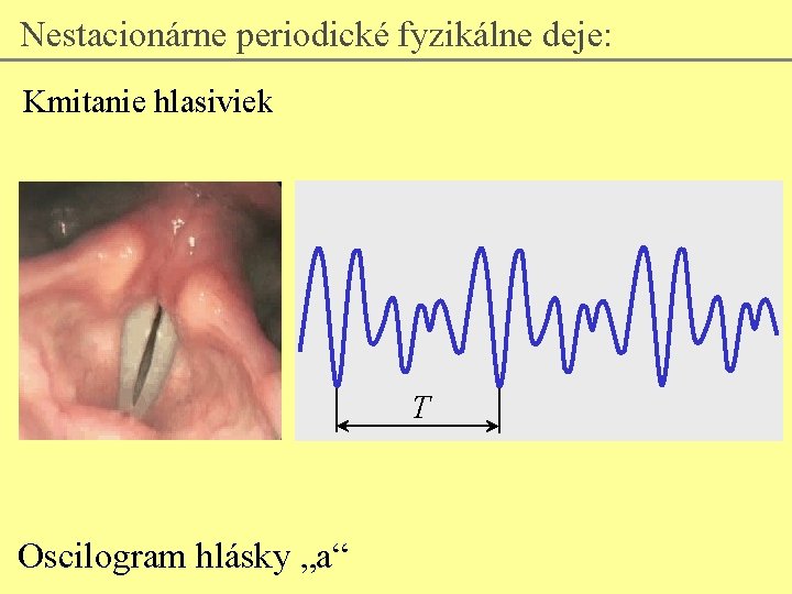 Nestacionárne periodické fyzikálne deje: Kmitanie hlasiviek T Oscilogram hlásky „a“ 