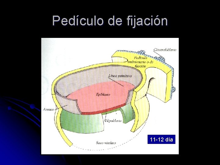 Pedículo de fijación 11 -12 día 