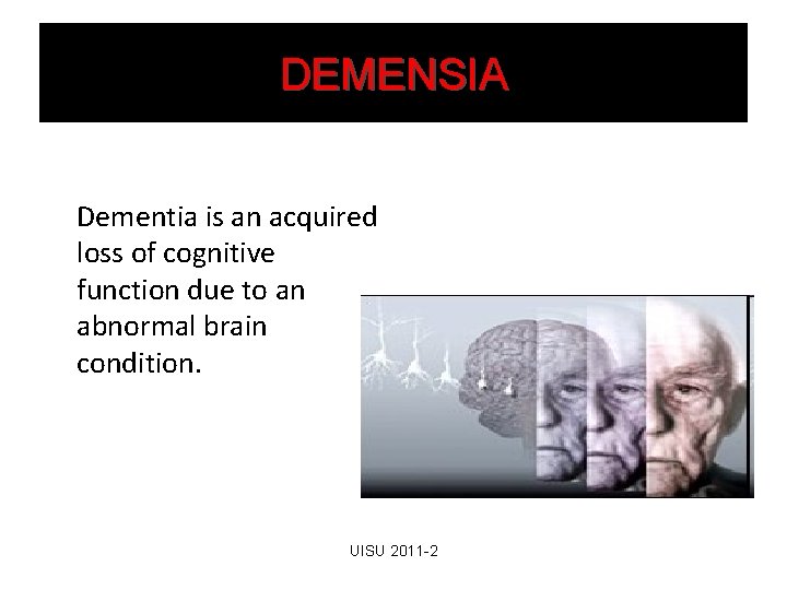 DEMENSIA Dementia is an acquired loss of cognitive function due to an abnormal brain