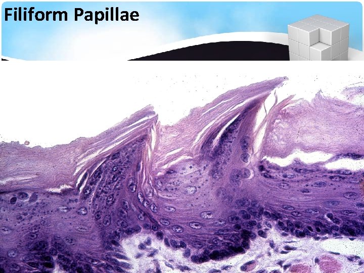 Filiform Papillae 