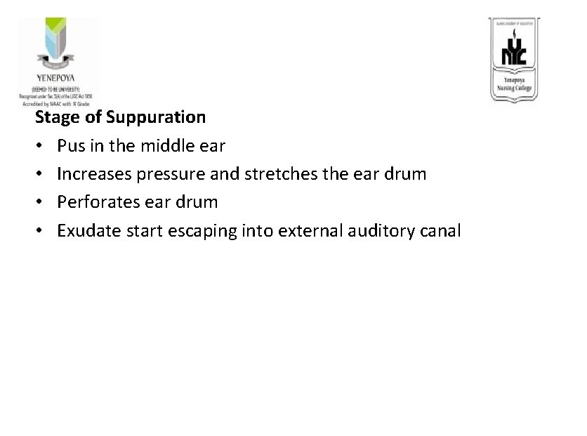 Stage of Suppuration • Pus in the middle ear • Increases pressure and stretches