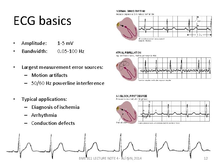 ECG basics • • Amplitude: Bandwidth: 1 -5 m. V 0. 05 -100 Hz