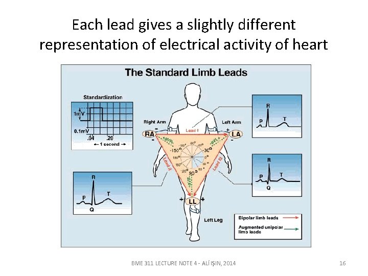 Each lead gives a slightly different representation of electrical activity of heart BME 311