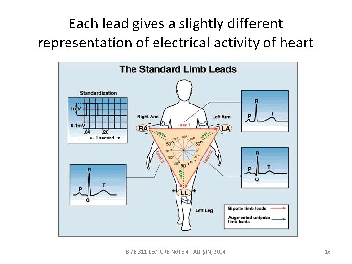 Each lead gives a slightly different representation of electrical activity of heart BME 311 Each lead gives a slightly different representation of electrical activity of heart BME 311