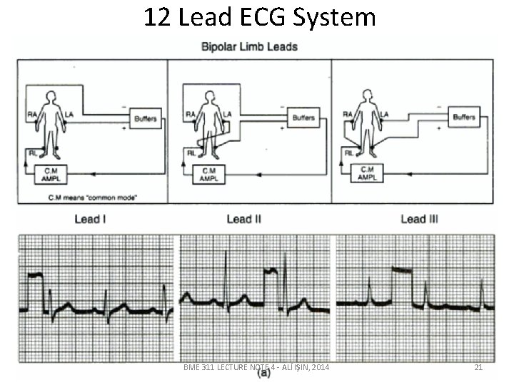 12 Lead ECG System BME 311 LECTURE NOTE 4 - ALİ IŞIN, 2014 21 12 Lead ECG System BME 311 LECTURE NOTE 4 - ALİ IŞIN, 2014 21