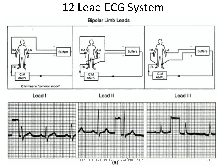 12 Lead ECG System BME 311 LECTURE NOTE 4 - ALİ IŞIN, 2014 21