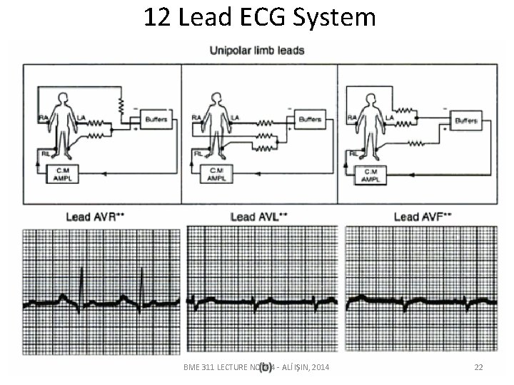 12 Lead ECG System BME 311 LECTURE NOTE 4 - ALİ IŞIN, 2014 22