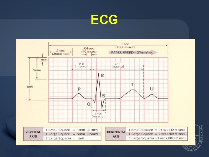 ECG 