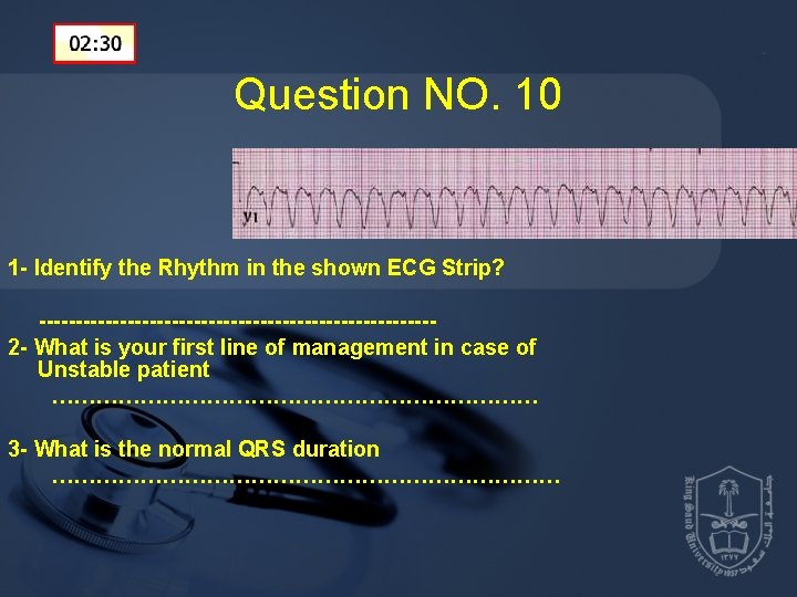 Question NO. 10 1 - Identify the Rhythm in the shown ECG Strip? ---------------------------2