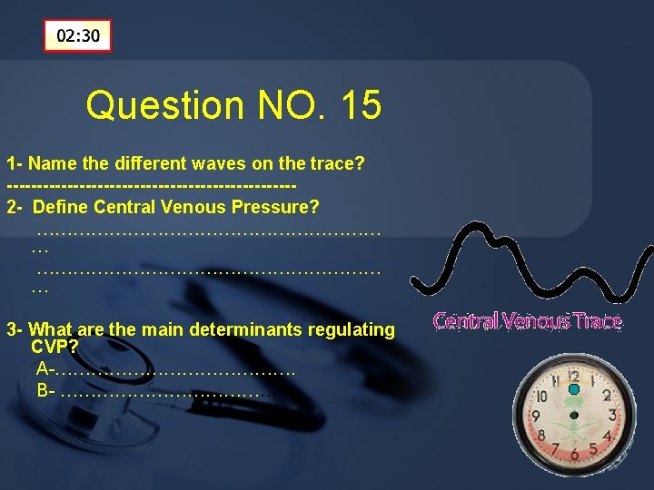 Question NO. 15 1 - Name the different waves on the trace? ------------------------2 -