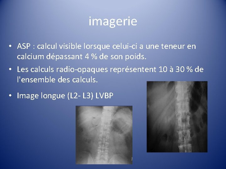 imagerie • ASP : calcul visible lorsque celui-ci a une teneur en calcium dépassant