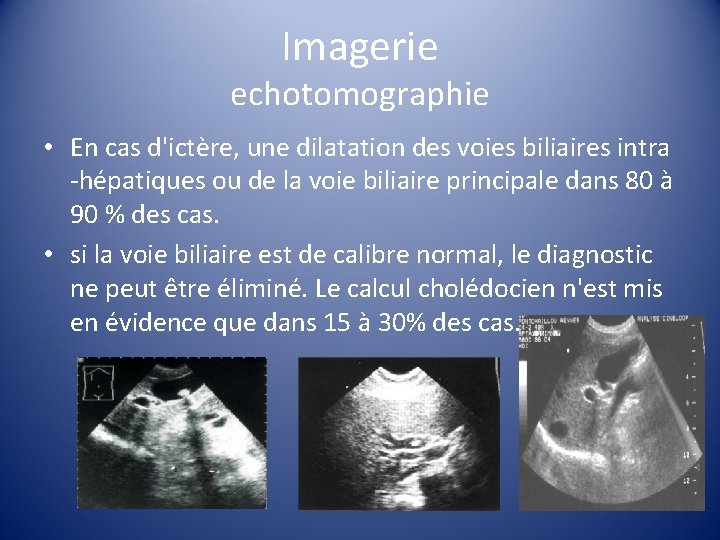 Imagerie echotomographie • En cas d'ictère, une dilatation des voies biliaires intra -hépatiques ou