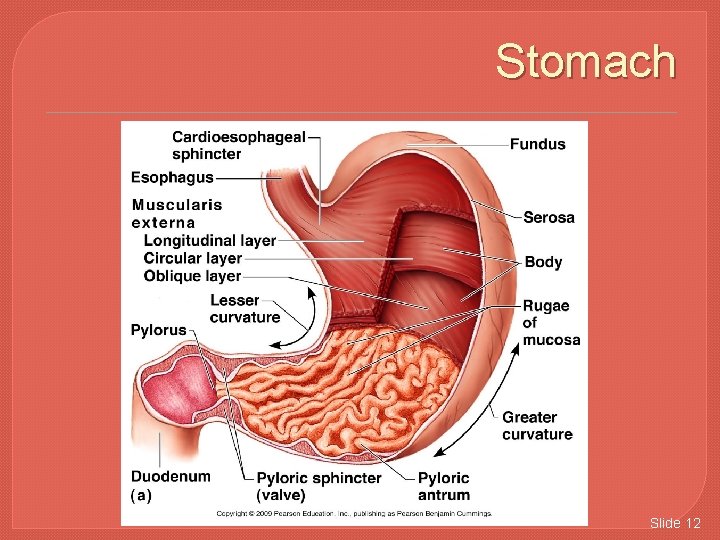 Stomach Slide 12 