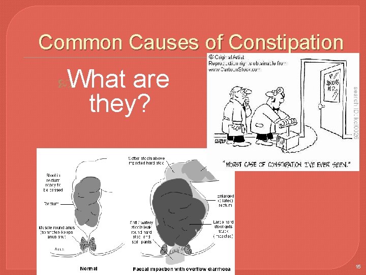 Common Causes of Constipation What are they? Copyright © 2016 by Elsevier, Inc. All