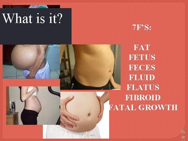 What is it? 7 F’S: FAT FETUS FECES FLUID FLATUS FIBROID FATAL GROWTH Sli