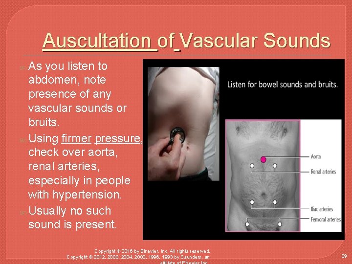 Auscultation of Vascular Sounds As you listen to abdomen, note presence of any vascular
