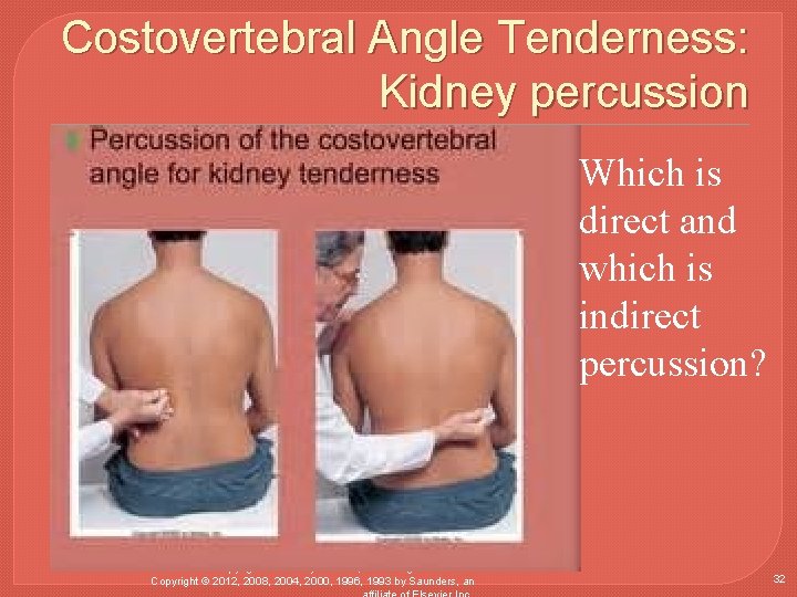 Costovertebral Angle Tenderness: Kidney percussion Which is direct and which is indirect percussion? Copyright