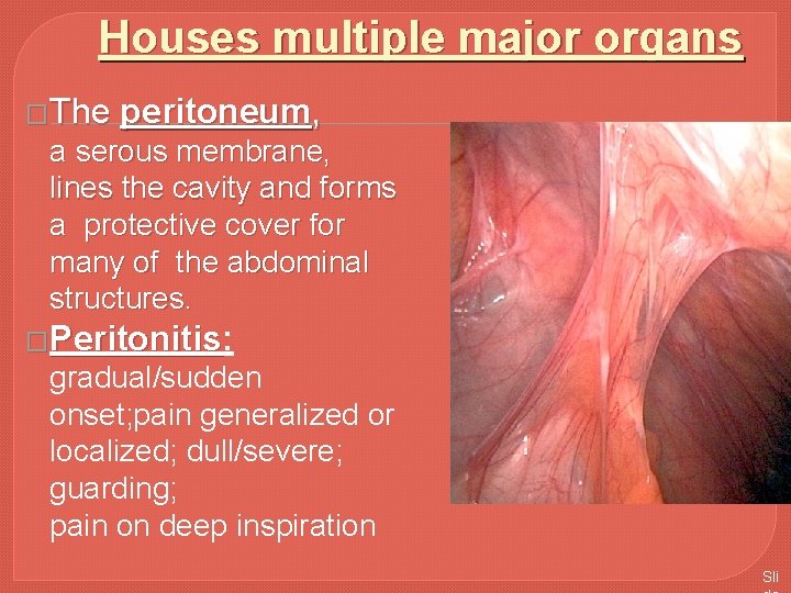 Houses multiple major organs �The peritoneum, a serous membrane, lines the cavity and forms