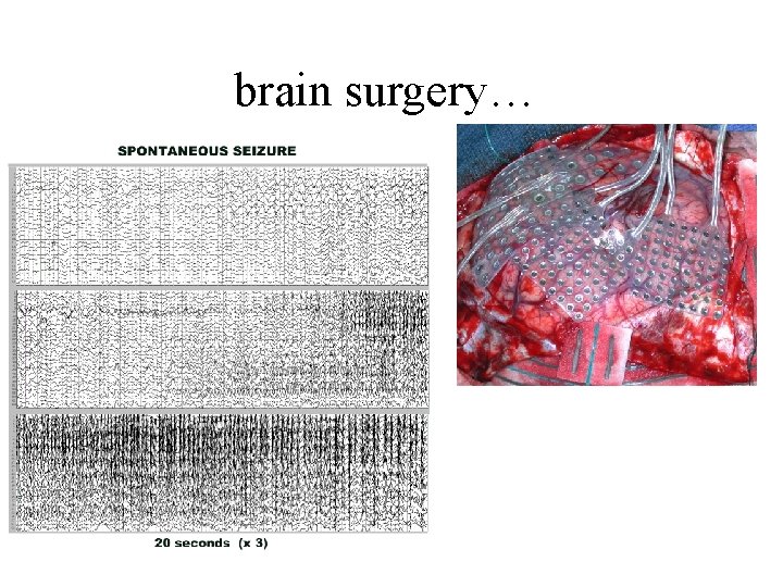 brain surgery… 