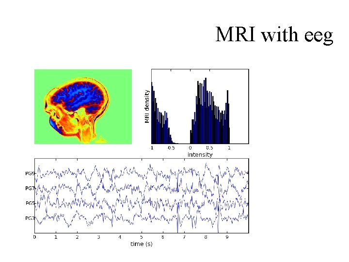 MRI with eeg 