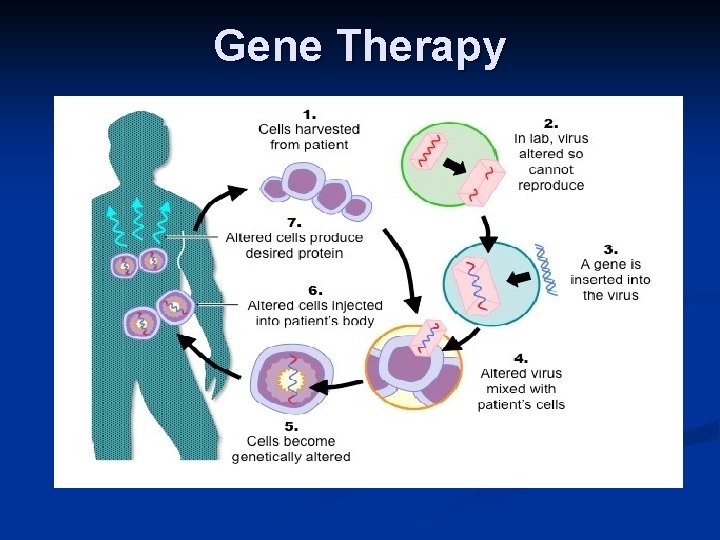 Gene Therapy 