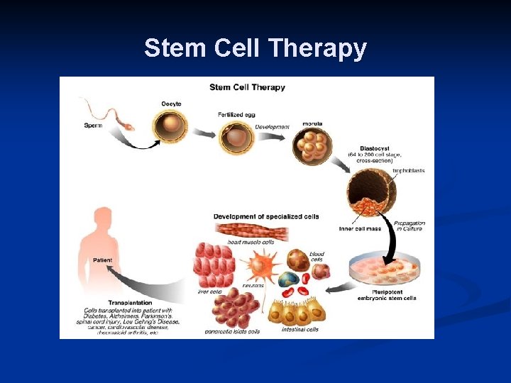 Stem Cell Therapy 