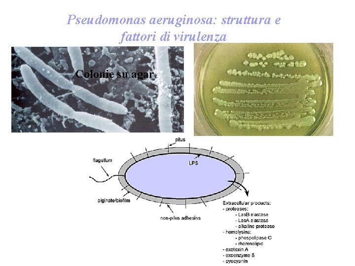 Pseudomonas aeruginosa: struttura e fattori di virulenza Colonie su agar 