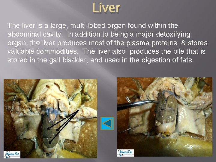 Liver The liver is a large, multi-lobed organ found within the abdominal cavity. In