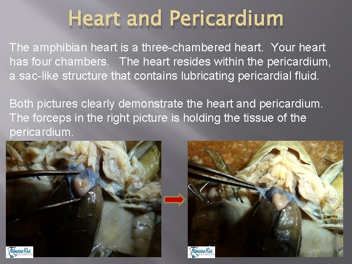 Heart and Pericardium The amphibian heart is a three-chambered heart. Your heart has four