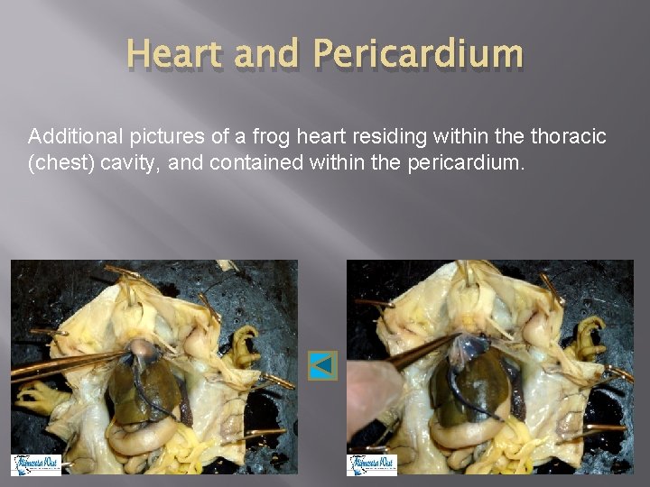 Heart and Pericardium Additional pictures of a frog heart residing within the thoracic (chest)