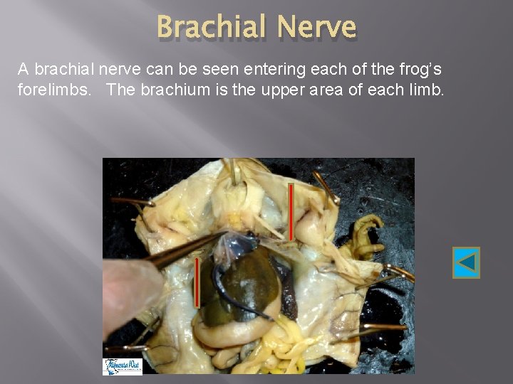 Brachial Nerve A brachial nerve can be seen entering each of the frog’s forelimbs.