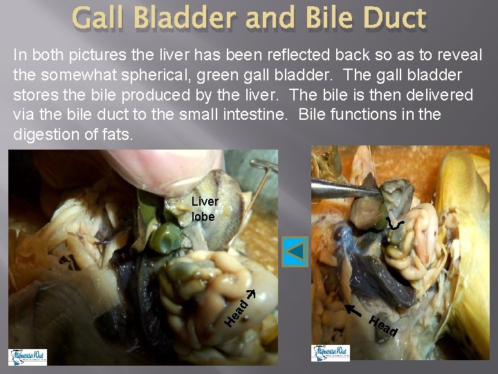 Gall Bladder and Bile Duct In both pictures the liver has been reflected back