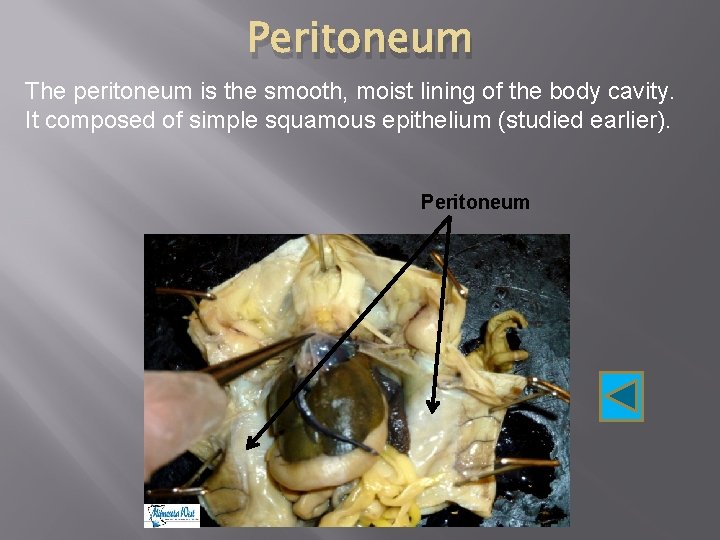 Peritoneum The peritoneum is the smooth, moist lining of the body cavity. It composed