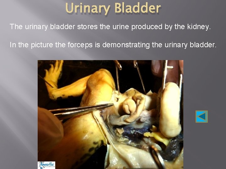 Urinary Bladder The urinary bladder stores the urine produced by the kidney. In the