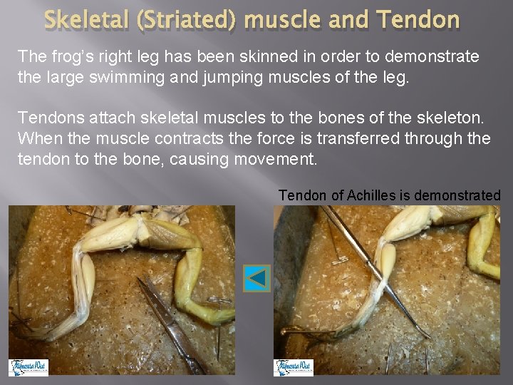 Skeletal (Striated) muscle and Tendon The frog’s right leg has been skinned in order