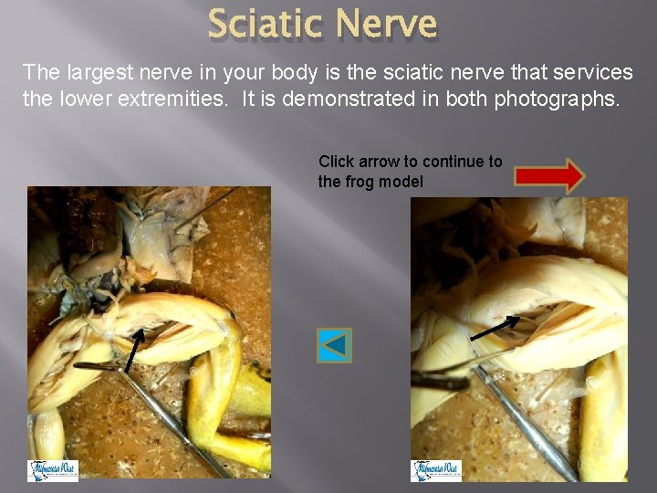 Sciatic Nerve The largest nerve in your body is the sciatic nerve that services