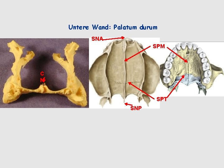 Untere Wand: Palatum durum SNA SPM C N SPT SNP 