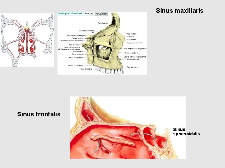 Sinus maxillaris Sinus frontalis Sinus sphenoidalis 