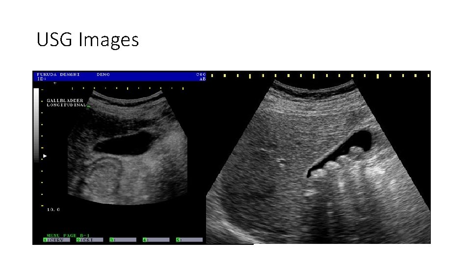 USG Images 